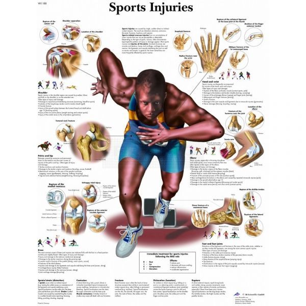 Ingelijste poster Sports Injuries - sportblessures 50,5 cm x 67,5 cm